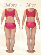 ピュアエステ ブリアント 新宿店&nbsp;20代 痩身結果