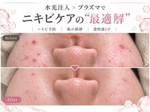アイムエステ 熊本店(i'm este)の雰囲気（フェイシャル悩みはi'mにお任せ！ニキビケアも◎[ニキビ/毛穴]）