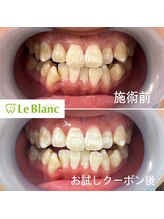 ルブラン 奈良店(Le Blanc)/ホワイトスポットも…