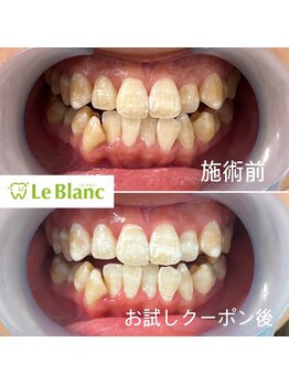 ルブラン 奈良店(Le Blanc)/ホワイトスポットも…