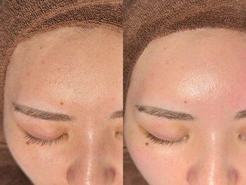 ルーナジェーナ(Luna llena)/池袋 エステ ルーナジェーナ