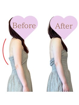 ココロ(COCORO)/姿勢・巻き肩ケア