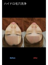 パリス デ スキン 岐阜マーサニジュウイチ店(Paris de skin)/【フェイシャル】Before/After