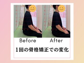 鈴木接骨院 青葉区小松島院/30代男性の1回での変化