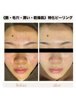 カナウ produced by きょうわ整体院(Kanau.)/《艶・毛穴・うるおい・乾燥肌》