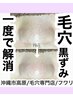 【お急ぎの方】毛穴ケア60分→時間が無いけど毛穴の黒ずみ綺麗にしたい方