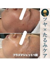 セレニア ボーテ(Selenia Beaute)/