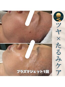 セレニア ボーテ(Selenia Beaute)/