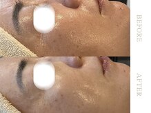 ソワ 恵比寿(soi)/ENVIRONエンビロンフルコース