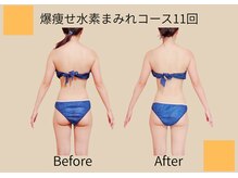 ヨサパーク ココロ 町田店(YOSA PARK COCORO)/Before After