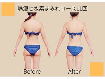 ヨサパーク ココロ 町田店(YOSA PARK COCORO)/Before After