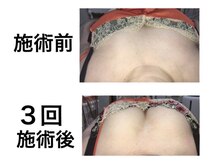 鍼灸サロンオランジュ 高槻富田院/