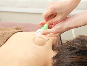 マチコ鍼灸院/吸い玉