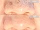 美デクリニカル(de)の写真