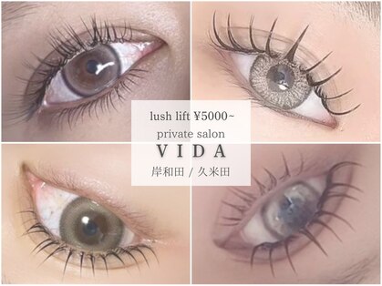 ヴィダ(VIDA)の写真