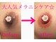 アンジュエール(Angeaile)の写真