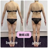 リスキン(Re:Skin)