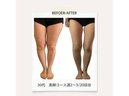 ヨサパーク アイリスリリィ 麻布十番店(YOSA PARK Irislily)の写真