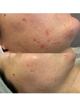 ヴィエルバ(VIELVA)/