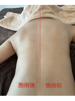 美バストアルファ(美bust α)/【バストアップ】背中もスッキリ