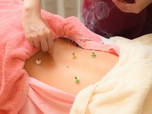 ミイ鍼灸院(mie鍼灸院)/腰痛鍼灸