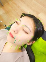 湘南Life鍼灸整体サロン 辻堂店/ライオン鍼-湘南life鍼灸整体