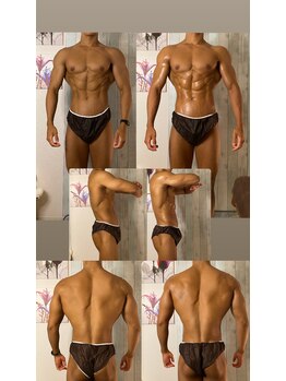 京橋メンズビューティーラボ(KMB LAB.)/ハイパーナイフのbefore/after