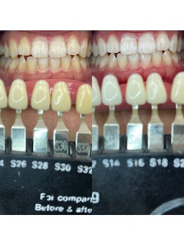 トウキョウスワーズ 池袋店(TOKYO SWRS)/#ホワイトニング #池袋 #渋谷