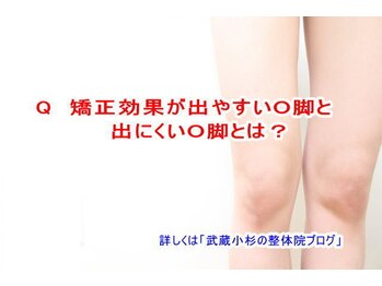 小池整体院/矯正効果が出やすいO脚とは?