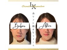 リュクス 恵比寿 代官山(LUXE)