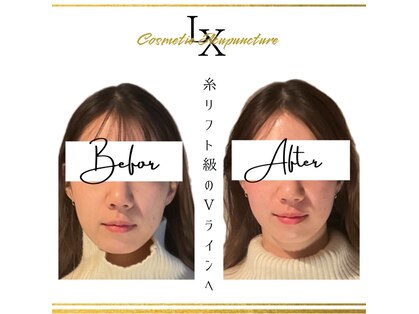 リュクス 恵比寿 代官山(LUXE)の写真