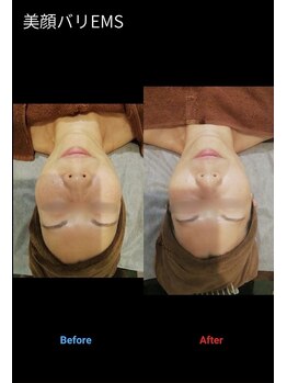 パリス デ スキン 岐阜マーサニジュウイチ店(Paris de skin)/【フェイシャル】Before/After