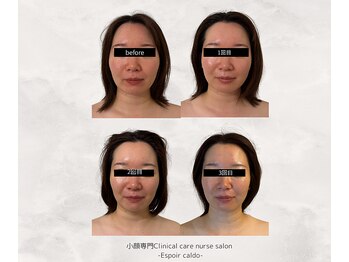 エスポワールカルド(Espoir caldo)/