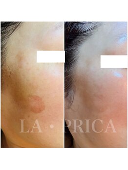 ラピリカ(LA PRICA)/