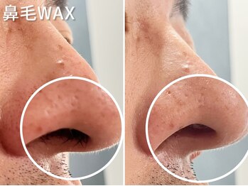 サルレ(Sarule)/鼻毛WAX/ワックス/メンズ/まゆげ