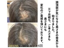 オリエンス(oriens)の雰囲気（純国産、純度100%のヒト幹細胞上清液トリプルショットで結果を！）