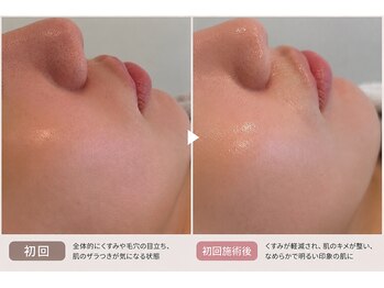 リッシュ 骨盤革命(RICHE.)/牛込神楽坂/韓国肌管理/美容整体
