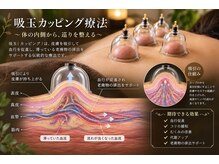 じぇいこぶすの雰囲気（人気の吸い玉カッピング療法。しつこい張りやコリがあるかたに。）