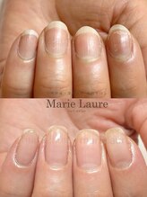 マリーロール 梅田店(Marie Laure)/深爪矯正/自爪育成/自爪風