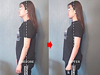 アトラス/初回のお客様のBefore＆after