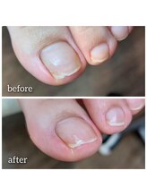 爪切り屋 足楽/