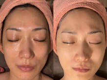 ヴィーナス(Venus)/白玉スキンプレミアム