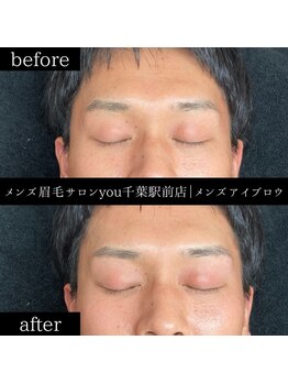 ユー 千葉駅前店(you)/ビフォ－アフター写真