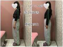 ユルル 刈谷店(Yururu)/変化(骨盤整体＆猫背整体)