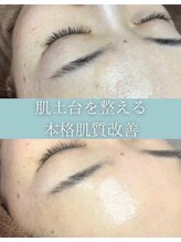 シェリール 浦和店(cherir)&nbsp;肌に 自信がつく