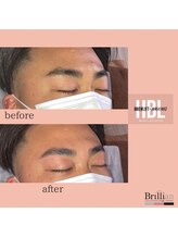 ブリリアン/メンズまゆ毛サロン　眉毛サロン