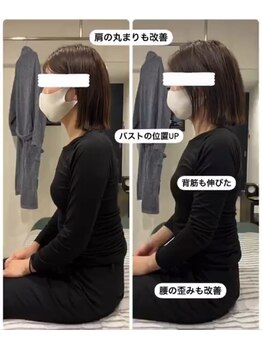 スパチャーレ(Spa ciare)/【骨盤矯正&猫背矯正】