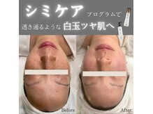 エルベ(ellbe)の雰囲気（シミケアプログラムで一気にツヤ美白肌◎）