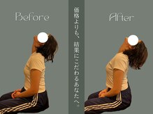 巡 金山店(MEGURI)/首の痛み改善