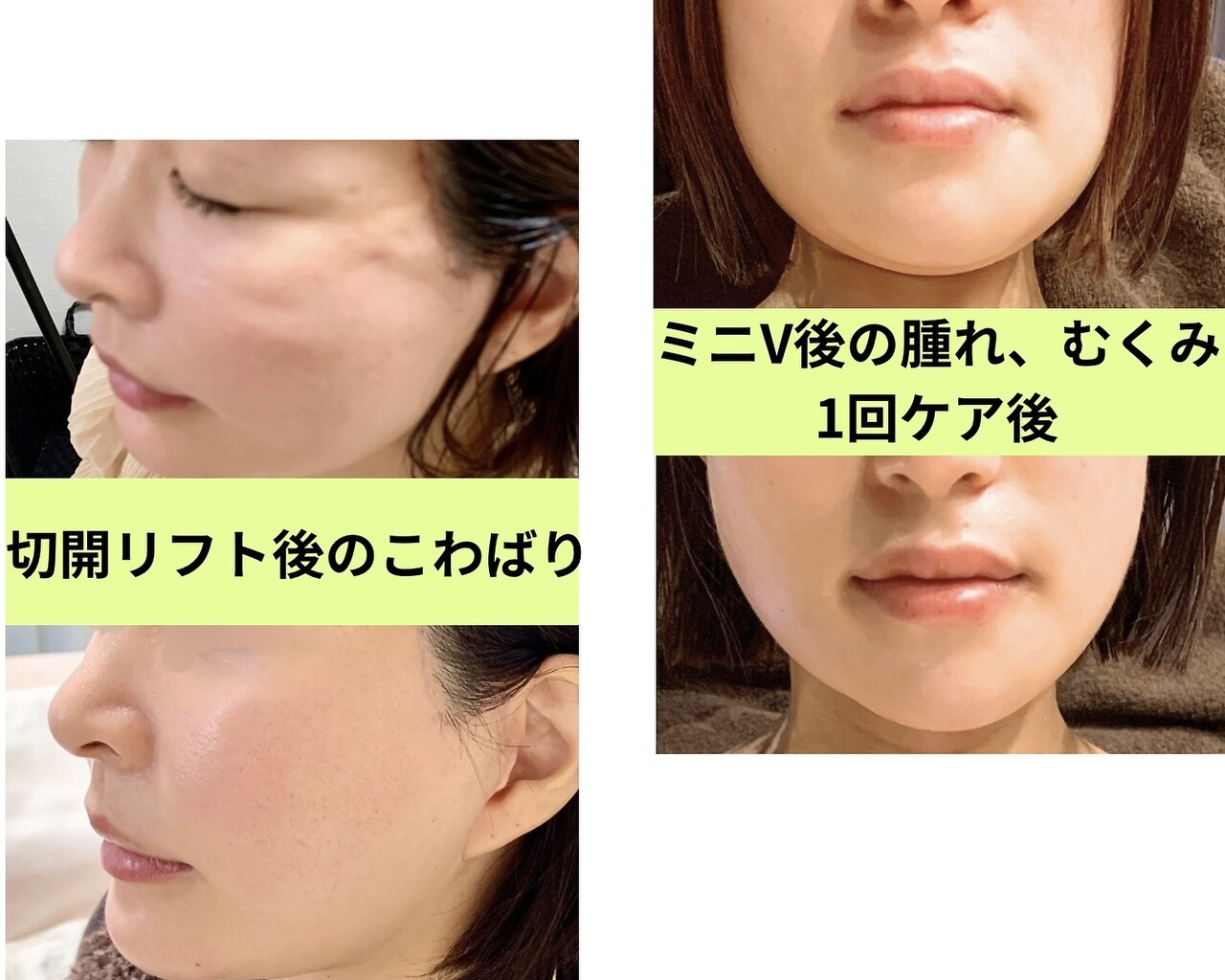 インディバ ミマリ(INDIBA ミマリ)｜ホットペッパービューティー